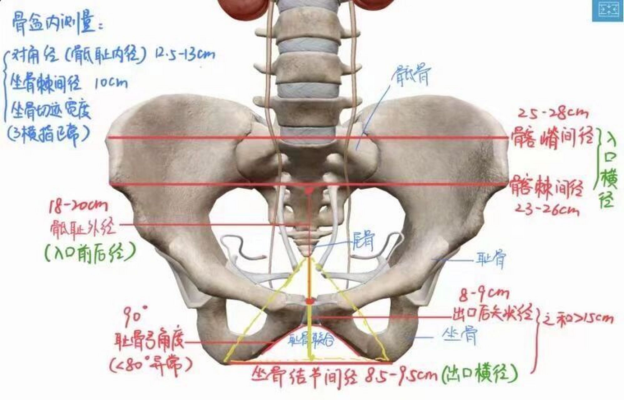 女性骨盆平面及径线图图片