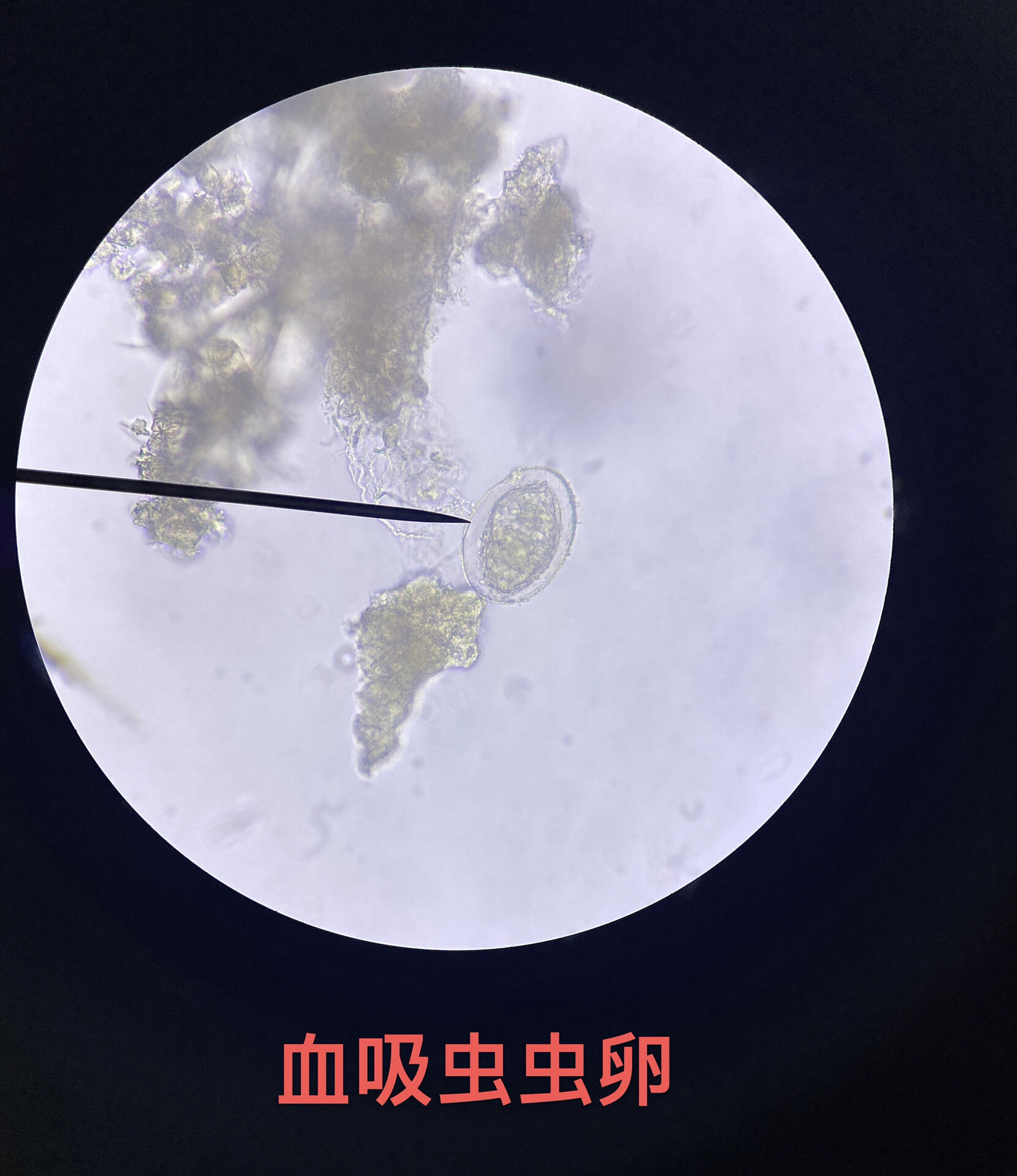 大便里的寄生虫卵你能认几个?有遇到吗?