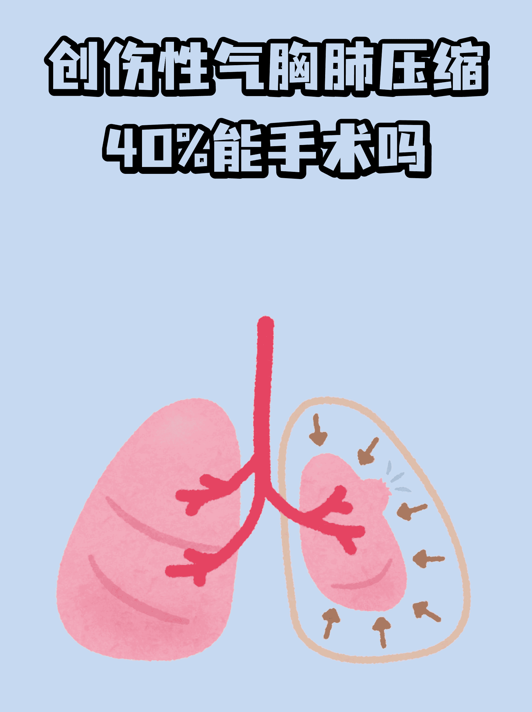 包含积水潭医院代挂专家号加代问诊复杂病情综合分析，治疗方向更明确的词条