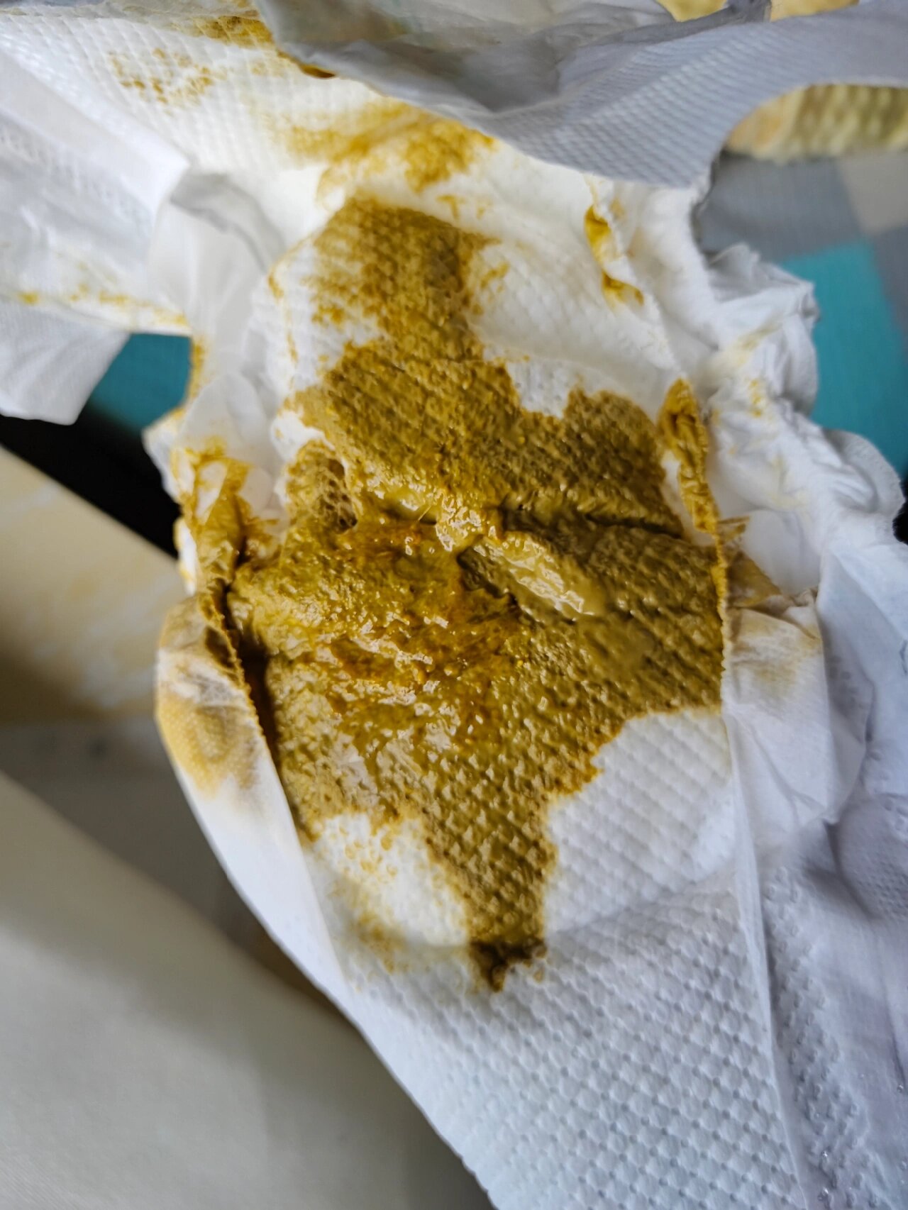 宝宝拉水状便是怎么好的?(内有大便图