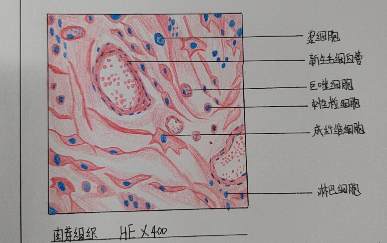 肉芽组织手绘图图片