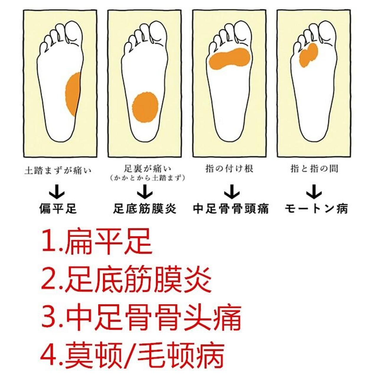 足底筋膜炎疼痛位置图图片