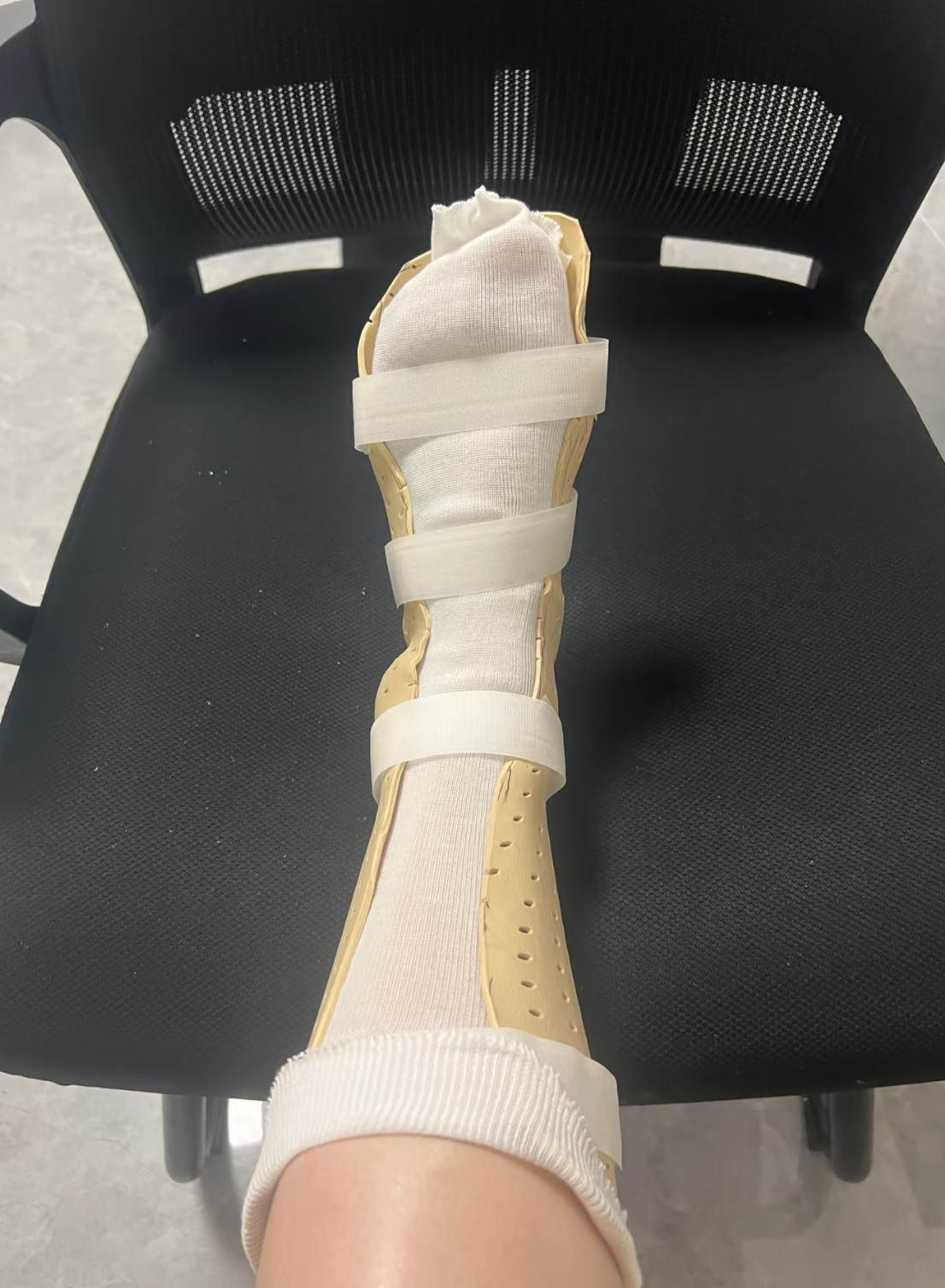 骨折病人可以吃菠萝蜜,但要注意适量