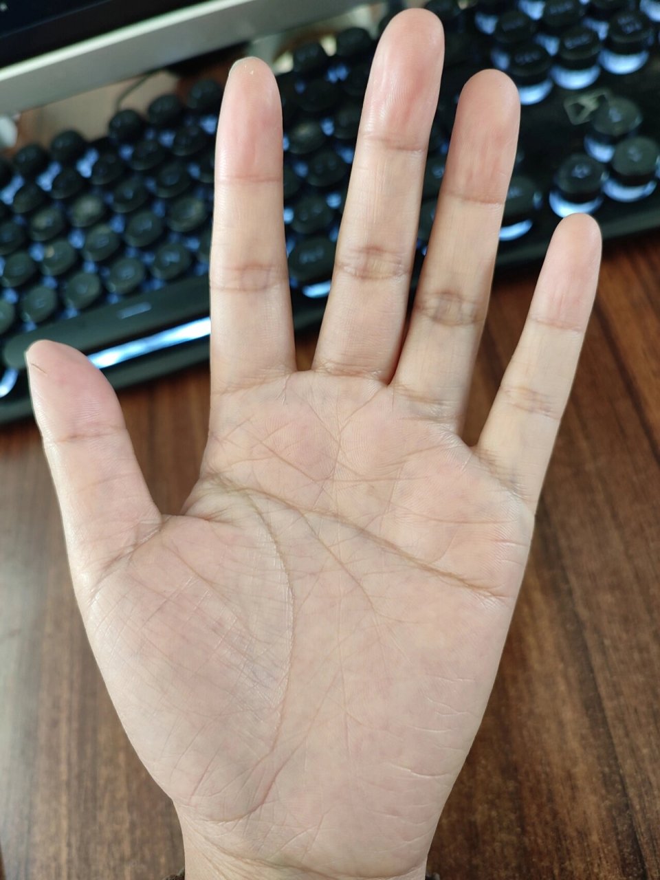 手掌心好白,是不是缺血了!