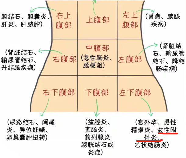 女性肚脐左下方疼痛常见原因包括附件炎,结肠炎和尿道结石
