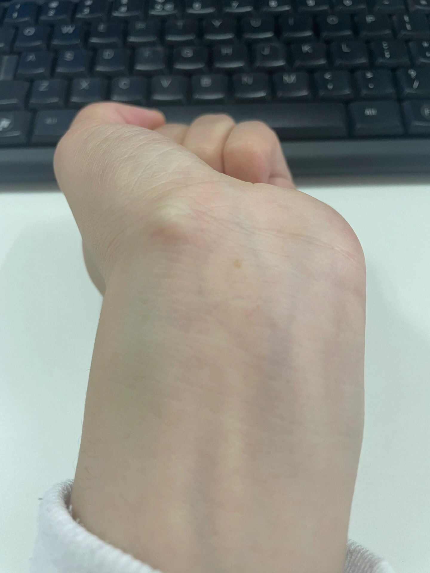 手腕鼓起一个包怎么回事?