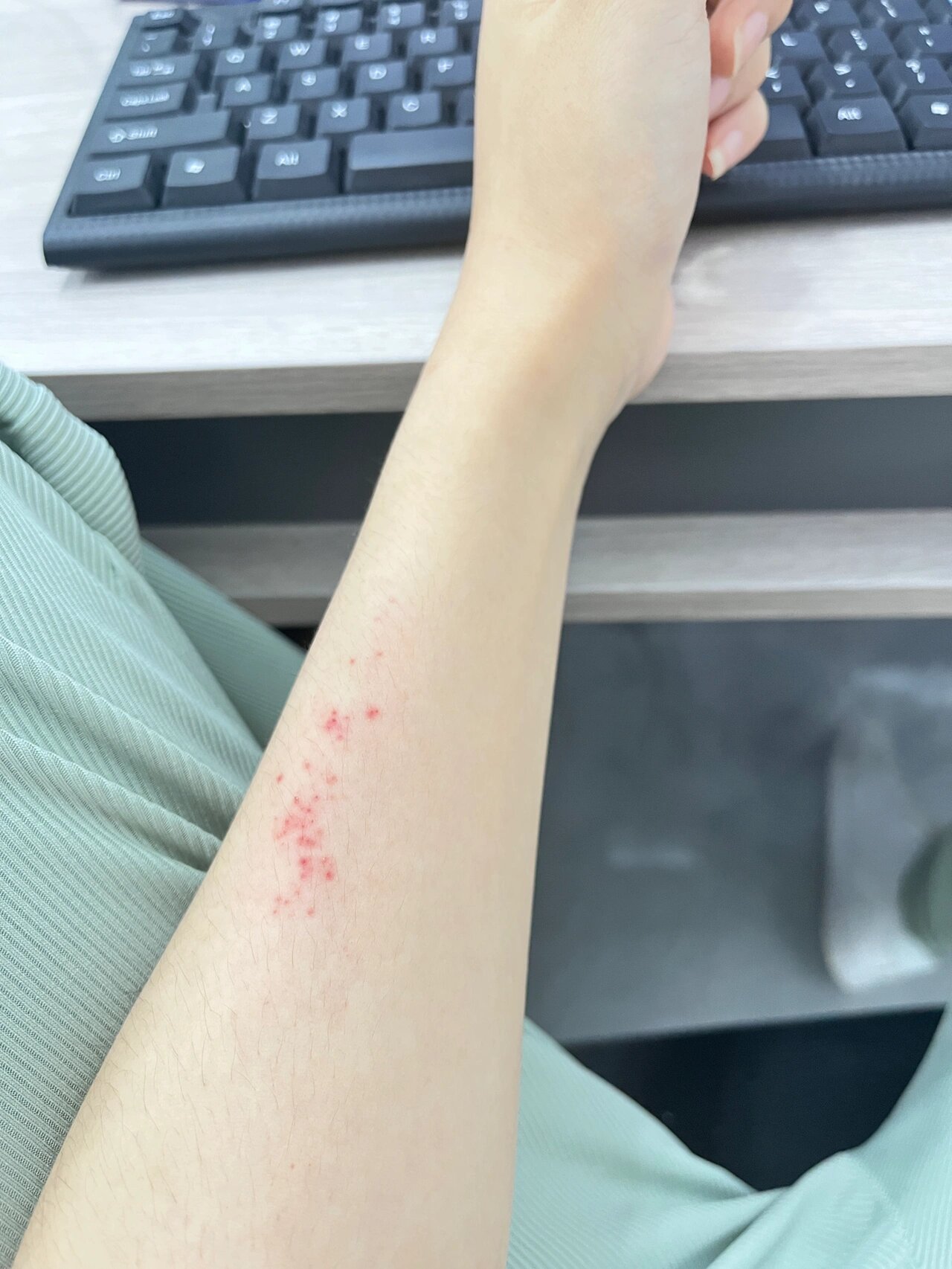 手臂一挠就起这种红血点