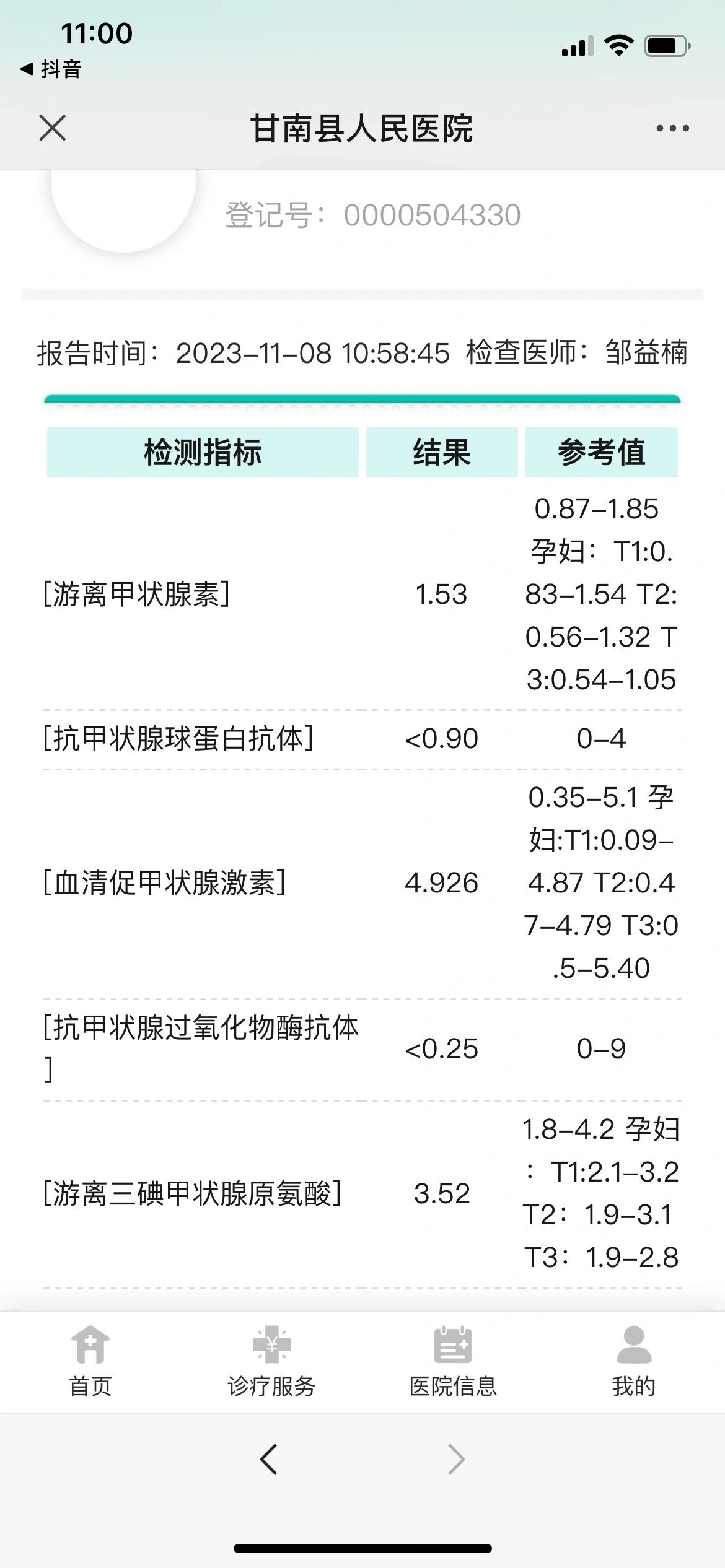 孕期甲减导致新生儿甲状腺异常 我们宝宝是10