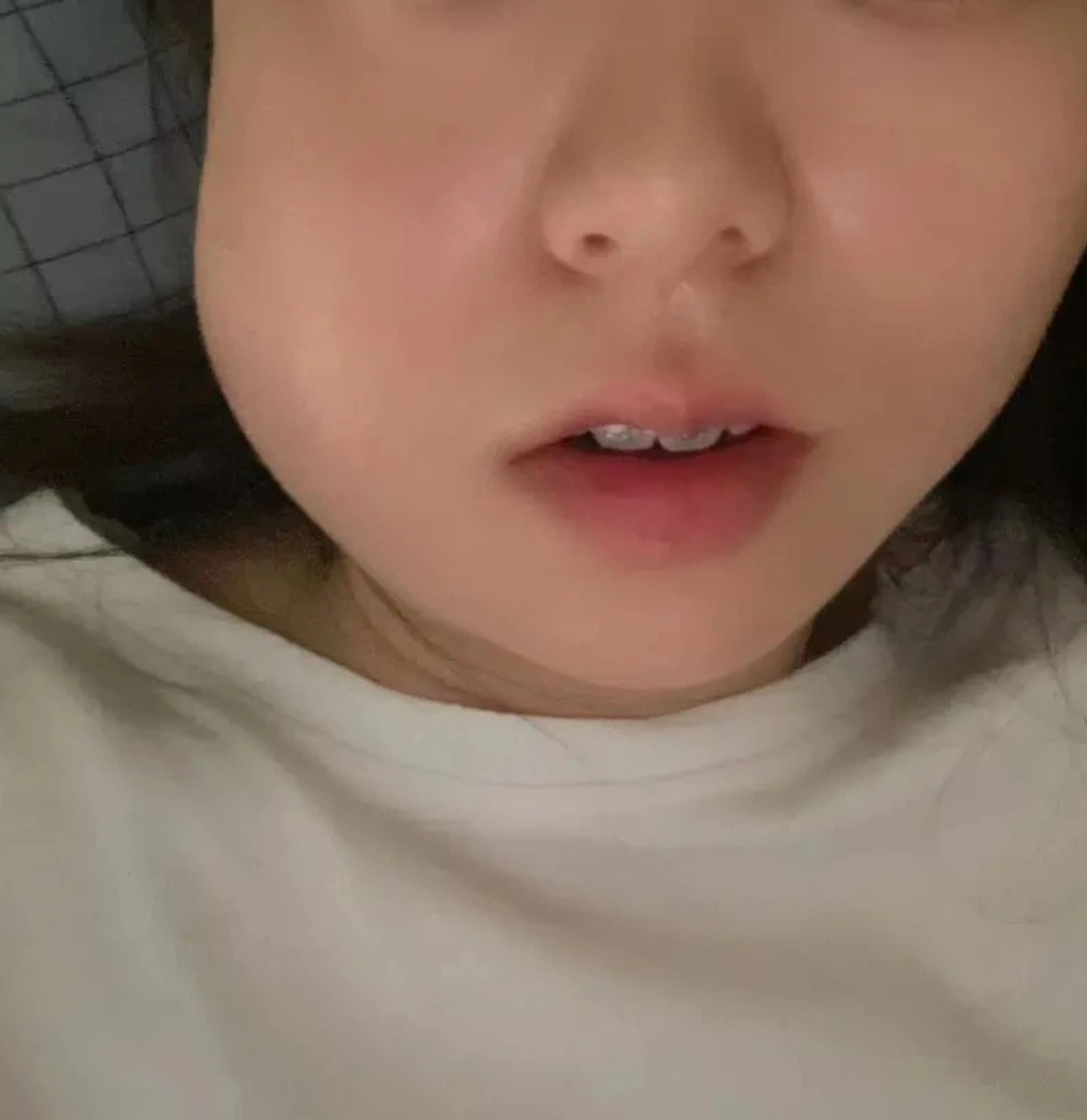 为什么脸肿了百科在线 为什么脸肿了百科在线