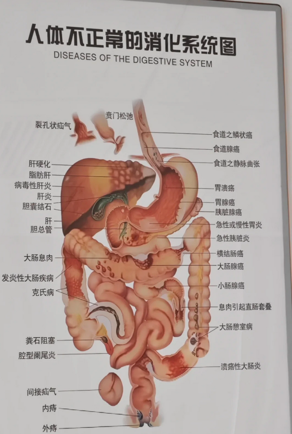 小肠在肚子里,上面连着胃的幽门,下面通过阑门连接大肠
