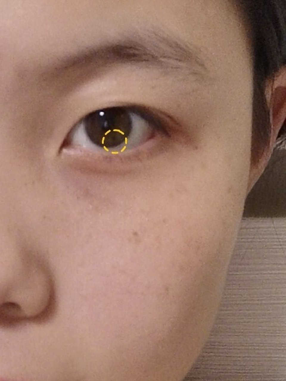 眼睛👀里的小黑点 姊美们 都谁的眼睛里有个小黑点啊 我是从小就有