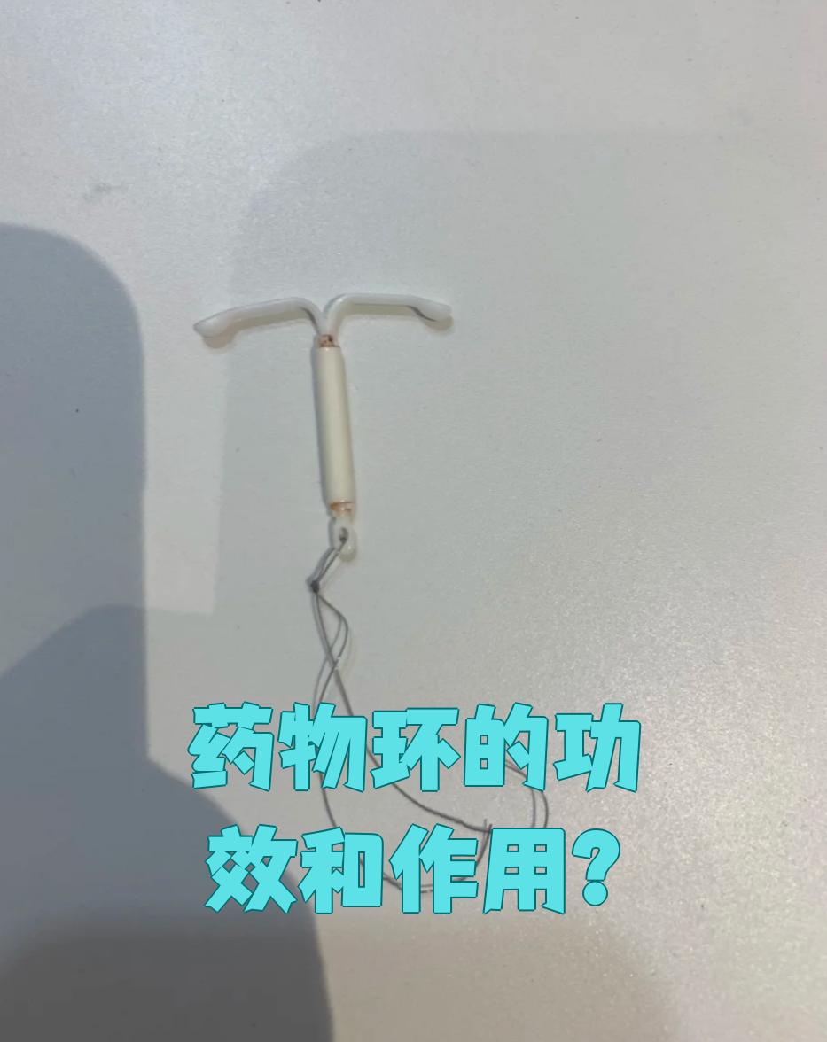 目前最常用的药物避孕环是曼月乐环,也叫左炔诺孕酮宫内缓释系统