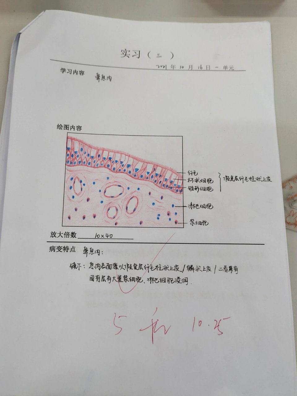 鼻息肉病理红蓝手绘图图片