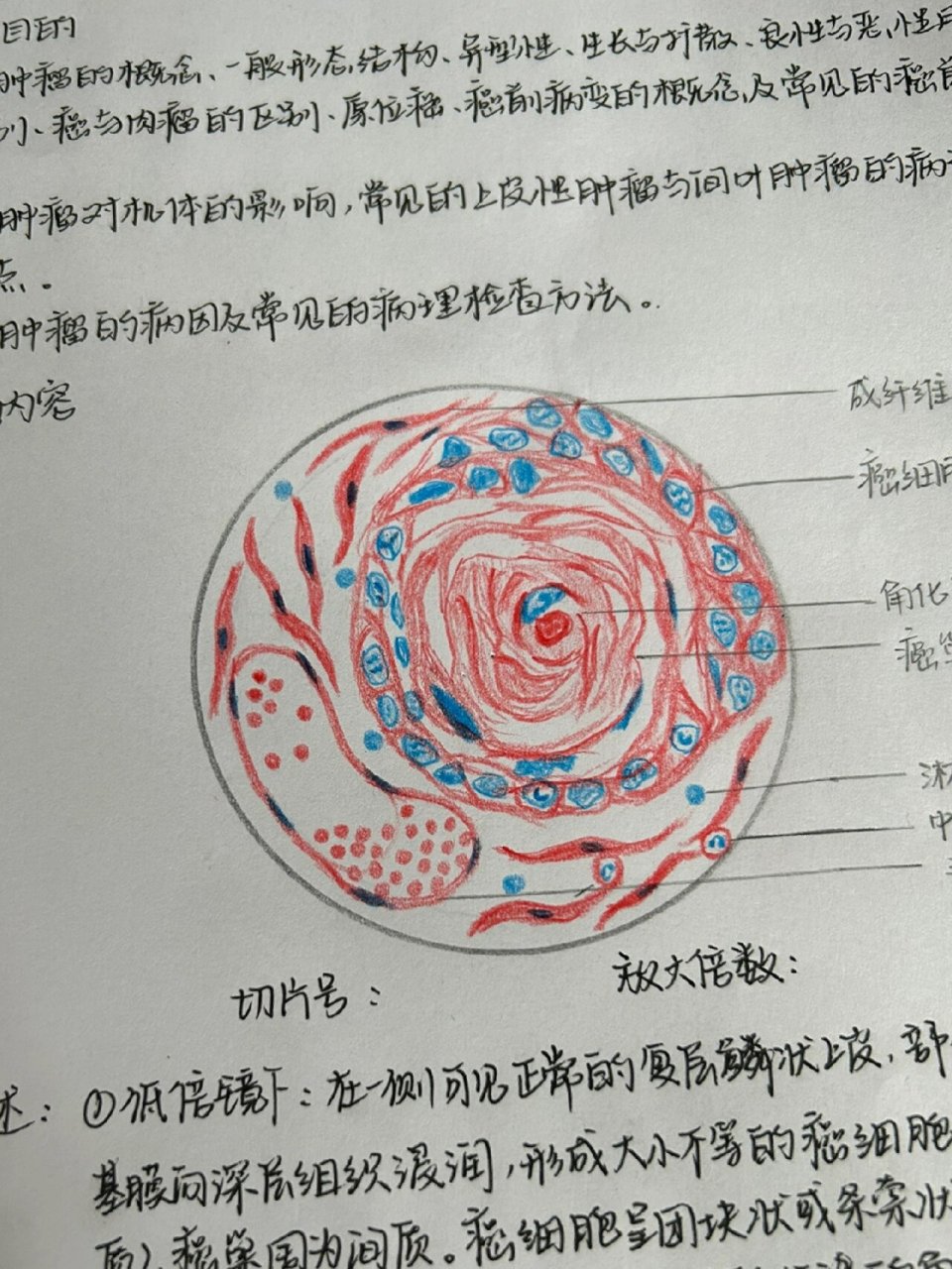 01            【肝细胞脂肪变】 【肉芽组织】 【混合血栓】