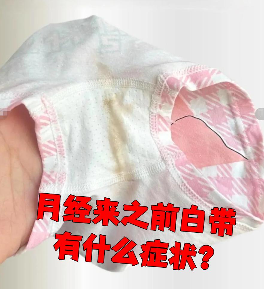 为什么白带多月经不来