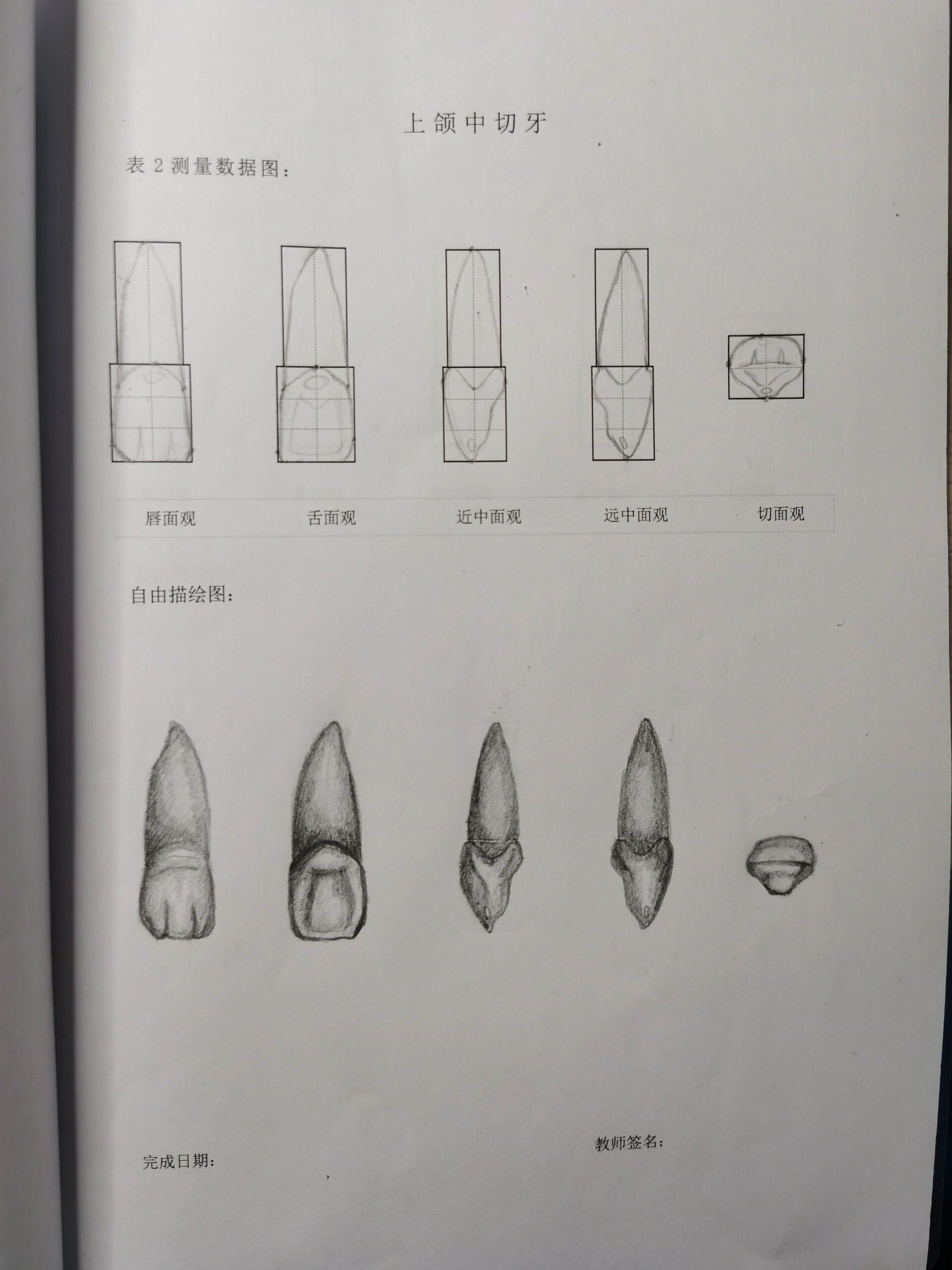 上颌中切牙唇面线图图片