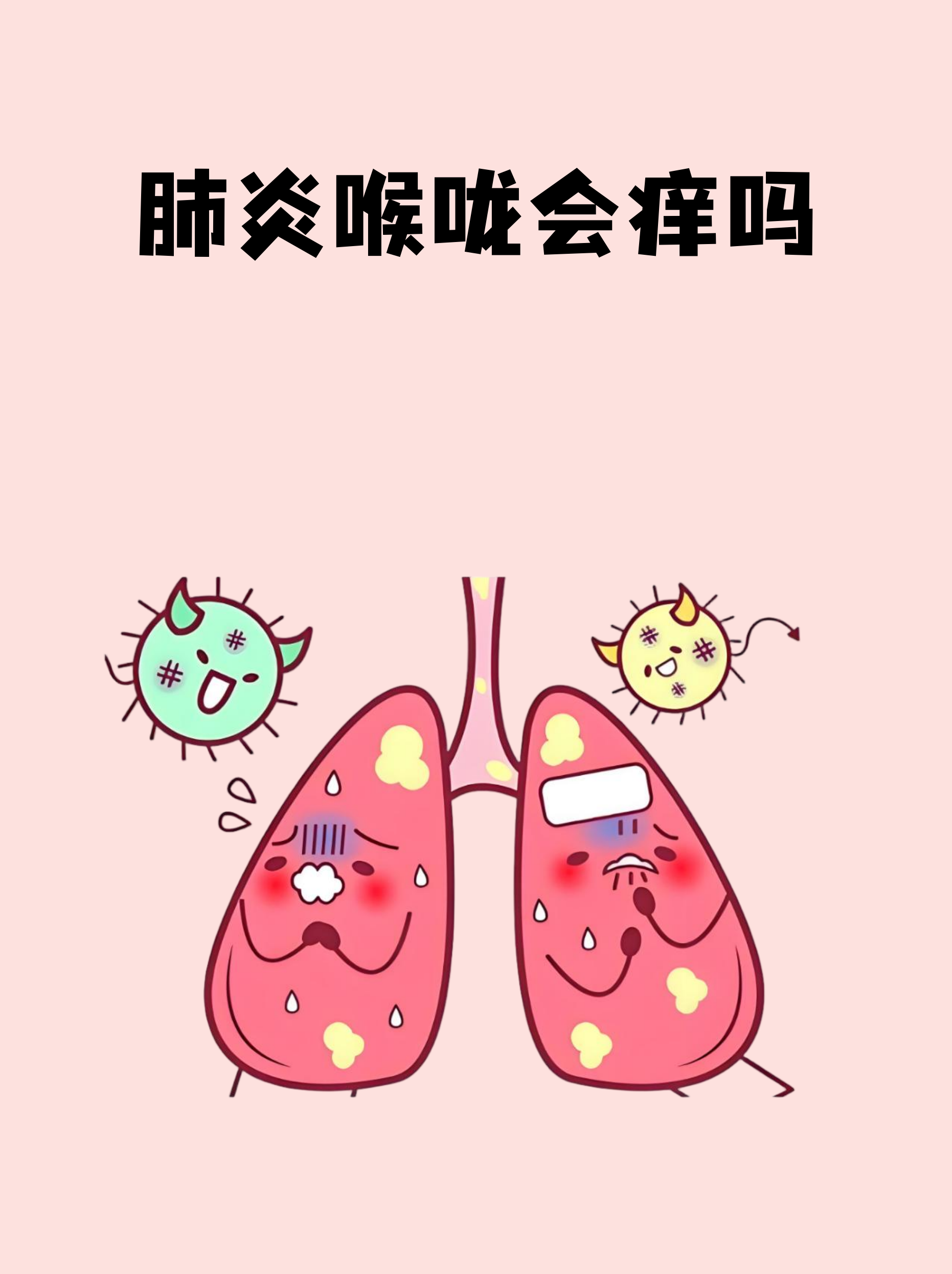  疫情咳嗽喉咙痒吗会传染吗(嗓子痒干咳会传染吗)