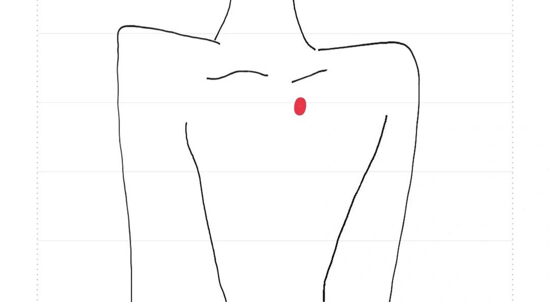 锁骨下面一点的位置 去年怀孕8个多月的时候,突然锁骨下方一点的这个