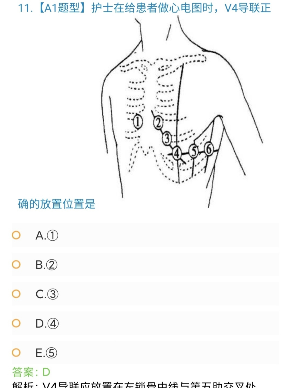 心电图导联位置 v1胸骨右缘第四肋间 v2胸骨左缘第四肋间 v3 v2与v4