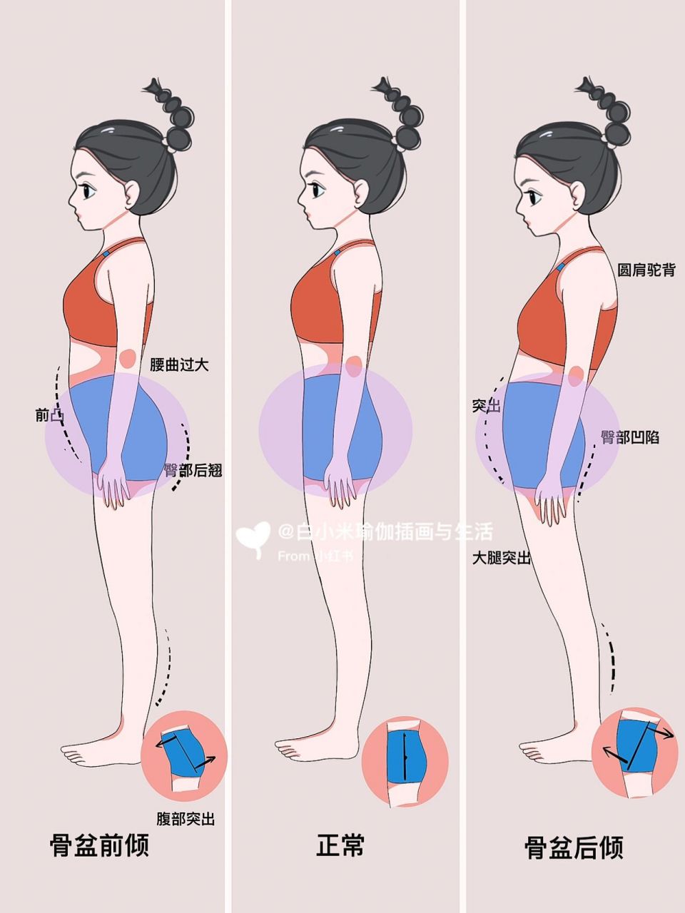 体态自测|怎样判断骨盆前倾还是骨盆后倾 全网都在流行的体态自测法