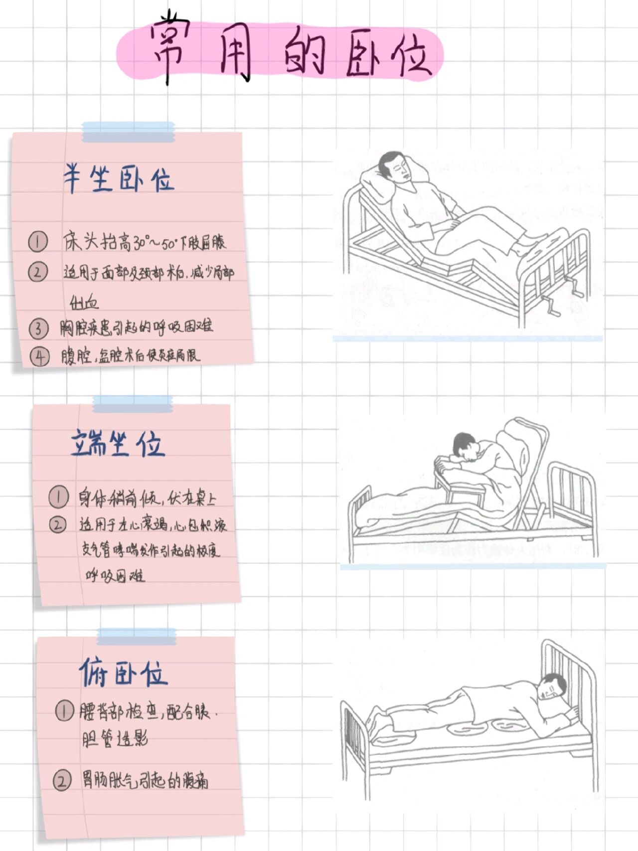 孕妇屈膝卧位姿势图片图片