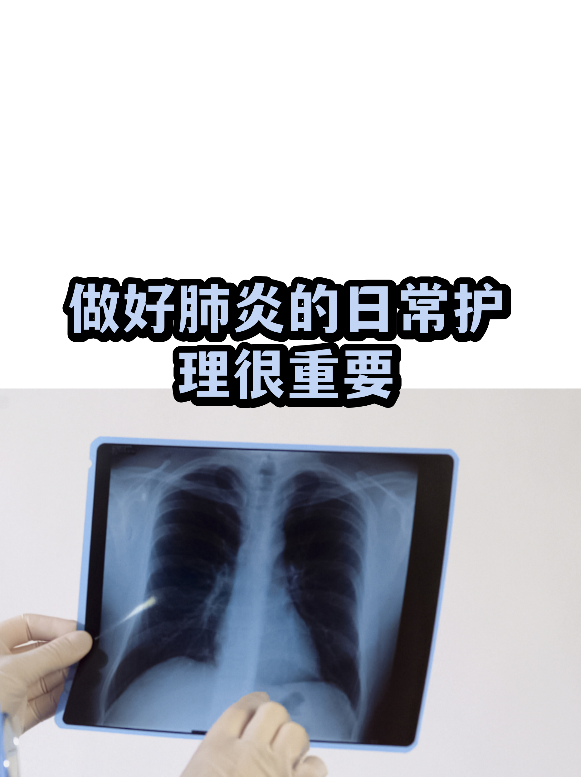 包含原火箭军总医院代诊挂号服务出院居家护理提醒，科学恢复身体的词条