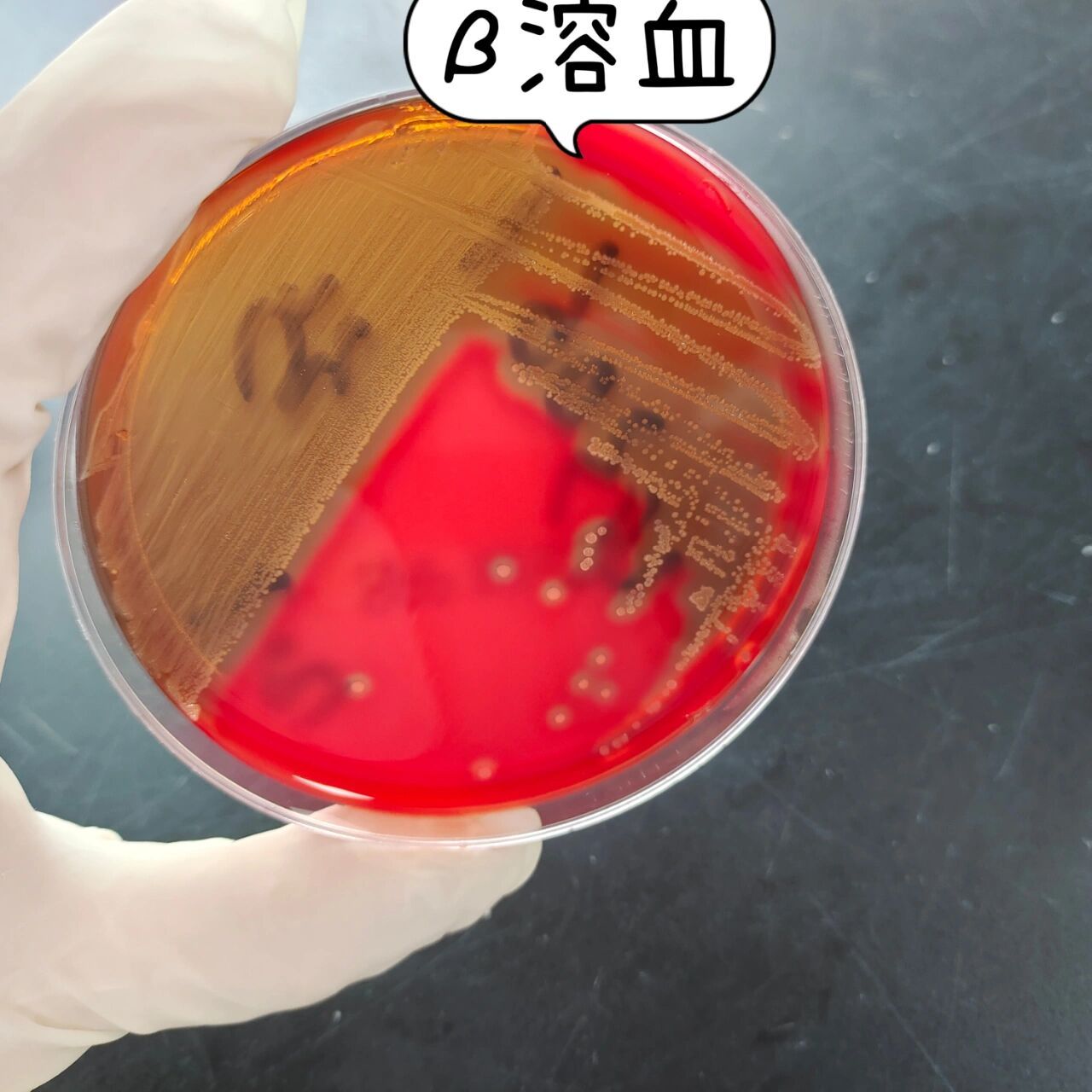 化脓性链球菌 革兰阳性球菌,单个,成双或链状排列,菌落较小,有β溶血