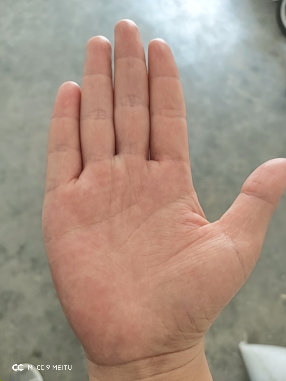 4,钱财纹多 钱财纹就是代表钱财的纹路.