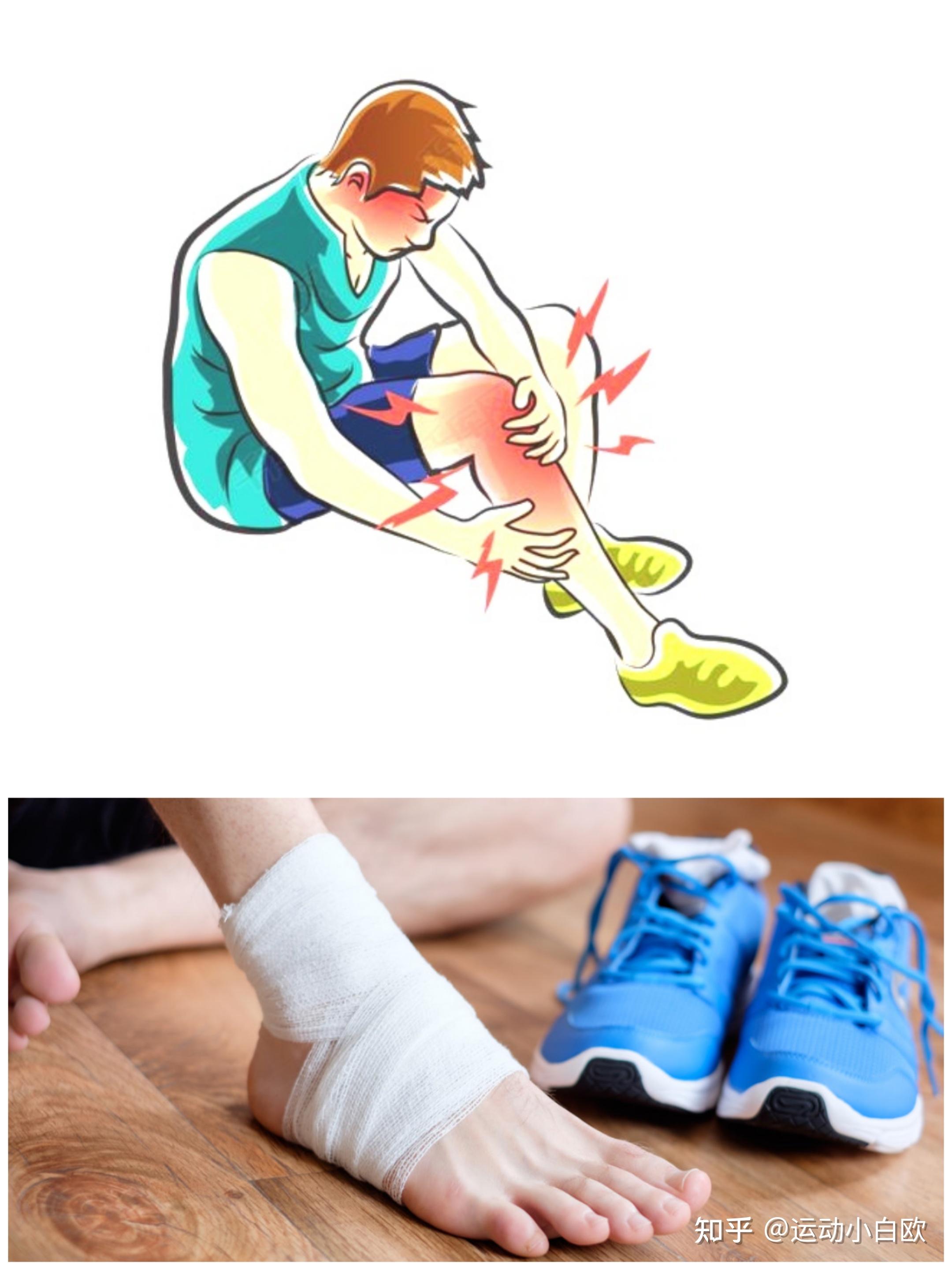 跑步那些事之常见伤处理