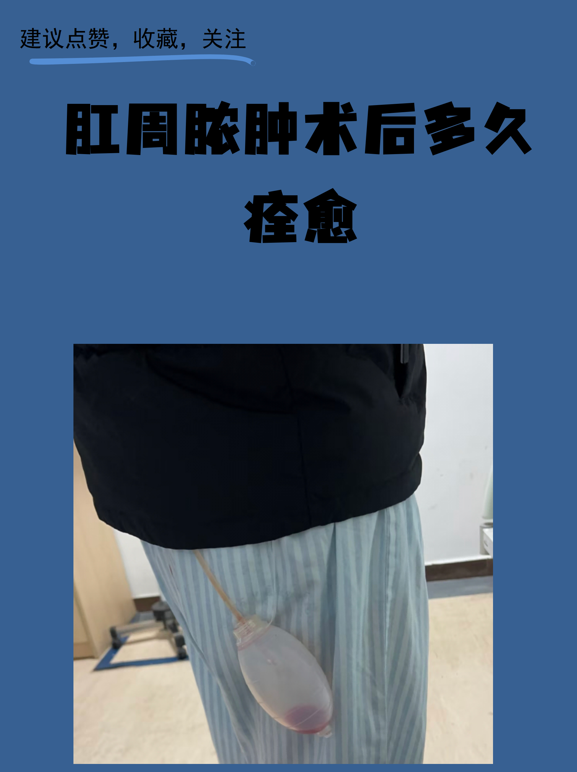 中国医学科学院整形外科医院代挂专家号服务术后康复全程跟踪，恢复不走弯路的简单介绍