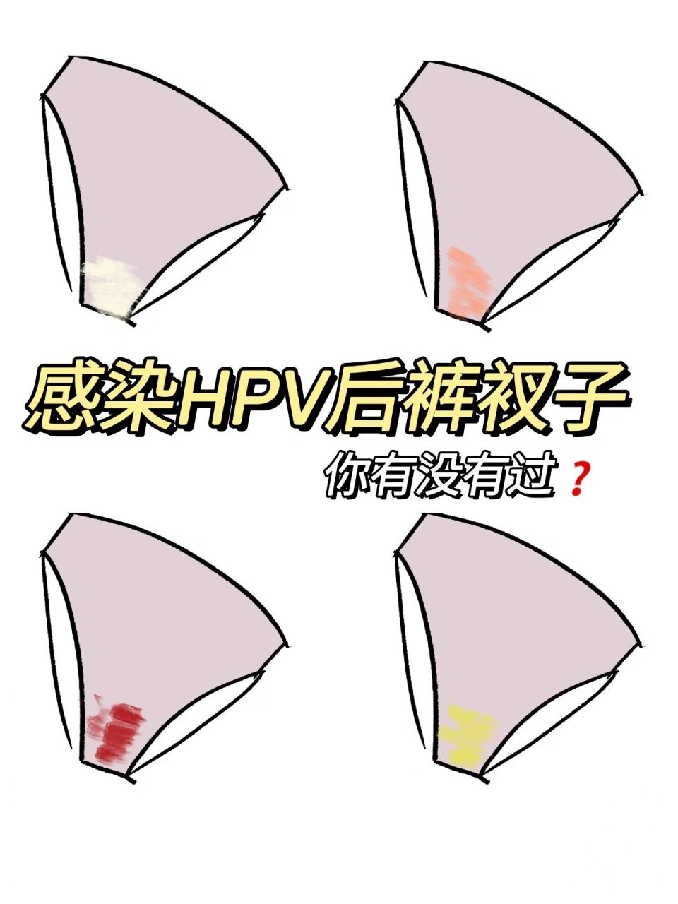 hpv感染3年才发现71内裤恨不得一天换三条 有没有这样的姐妹,不知道