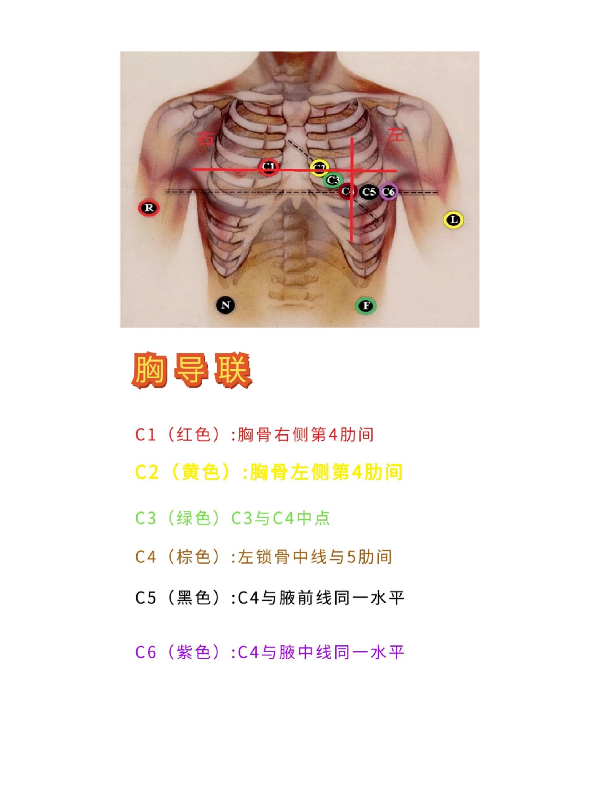 心电图导联真人图图片