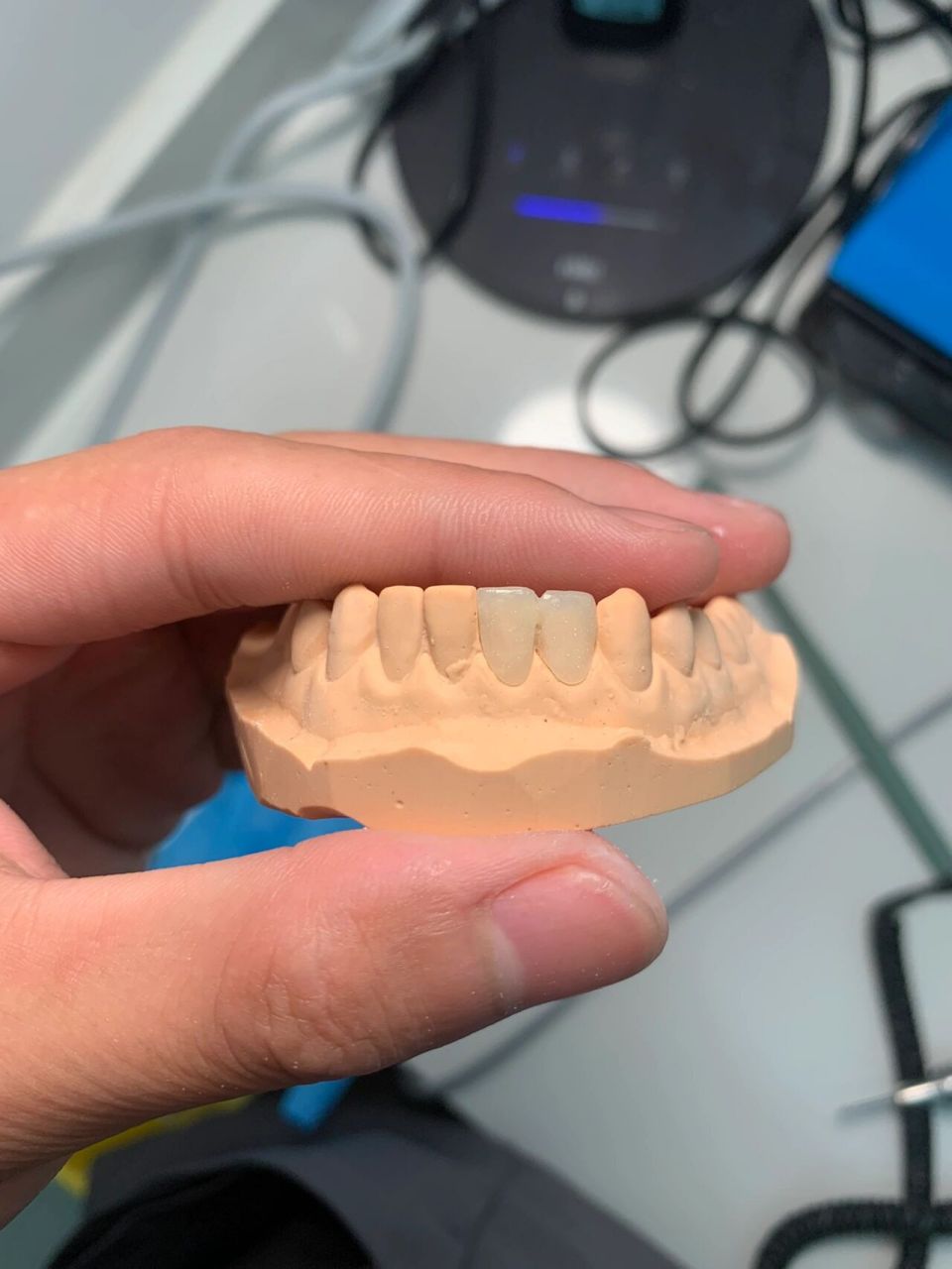 这样的临时牙 患者还想来吗 前两天磨的眼睛累死啦  效果还不错 有