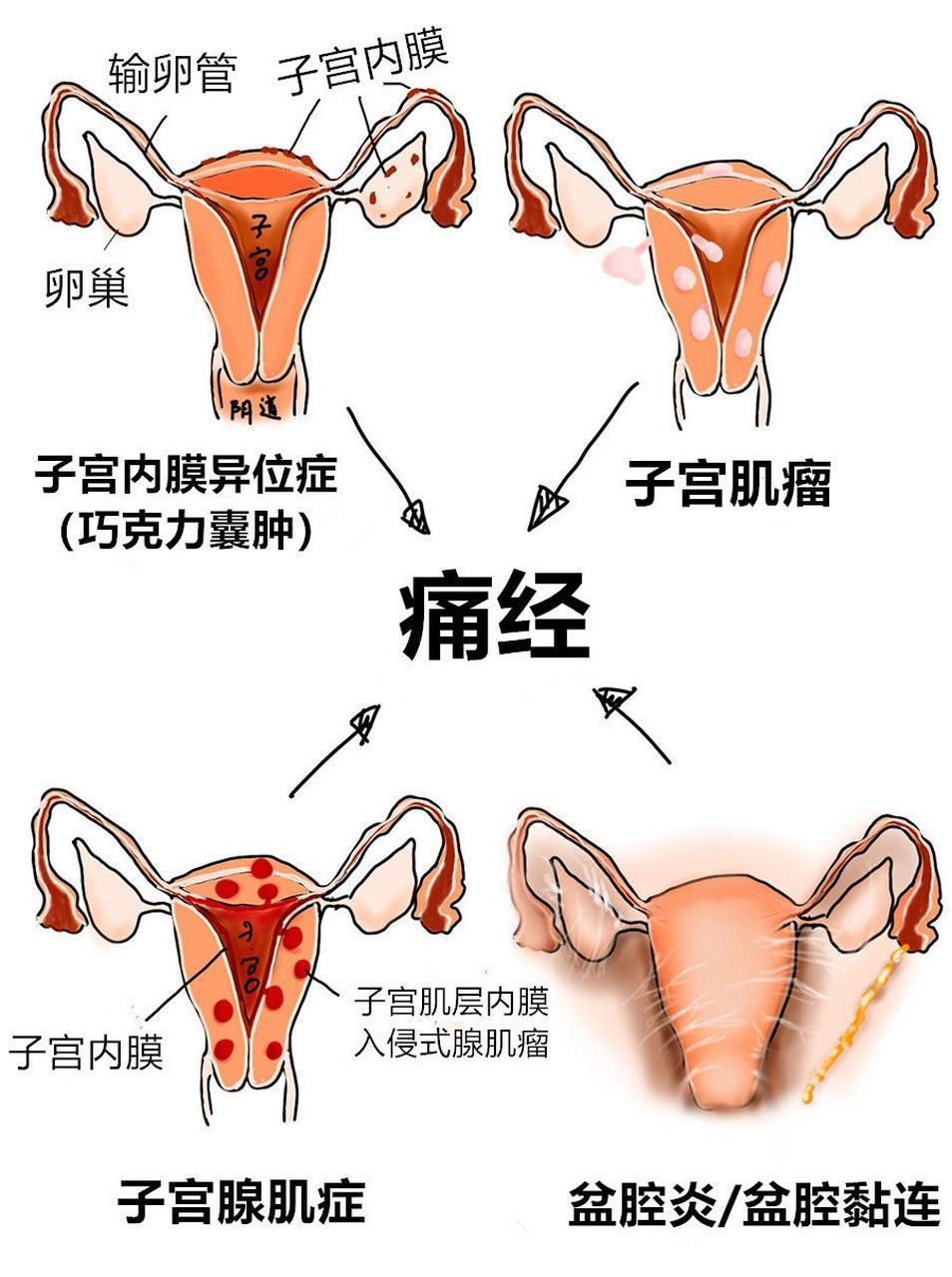 桥囊图片