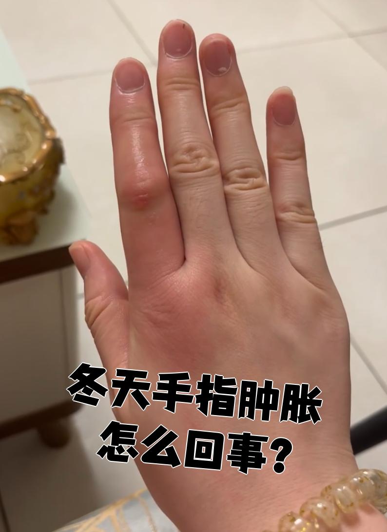 手为什么凉 手为什么凉