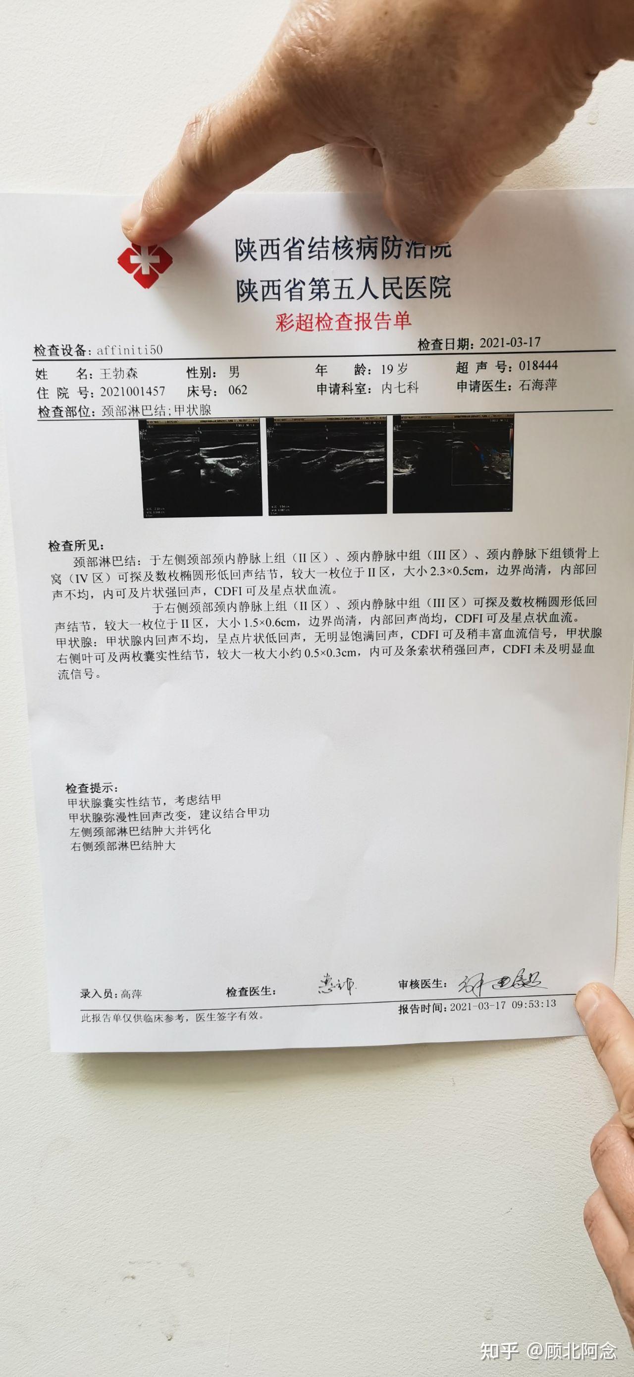 结核病化验单图片图片