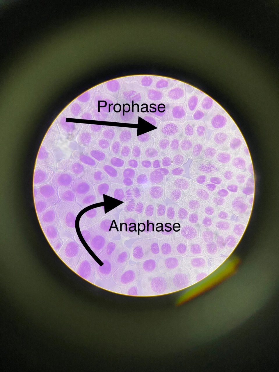 division—mitosis annie老师做的临时装片,观察大蒜根尖组织有丝分裂