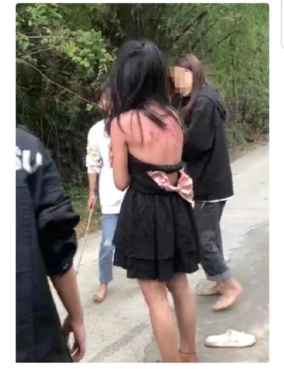 海南临高,一名初中女孩王丽(化名)遭遇校园霸凌,被一群女孩群殴,还将
