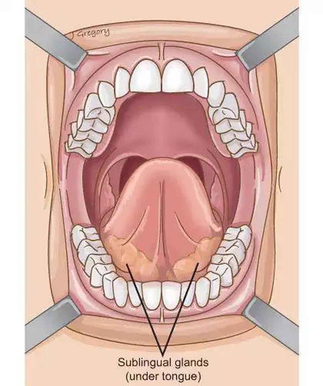 舌下腺位置图片