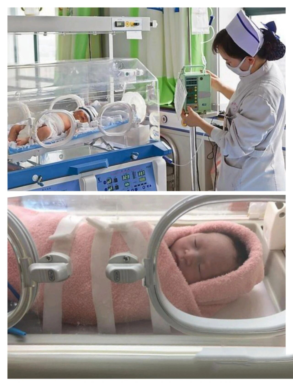 早产儿保温箱有哪些功能?