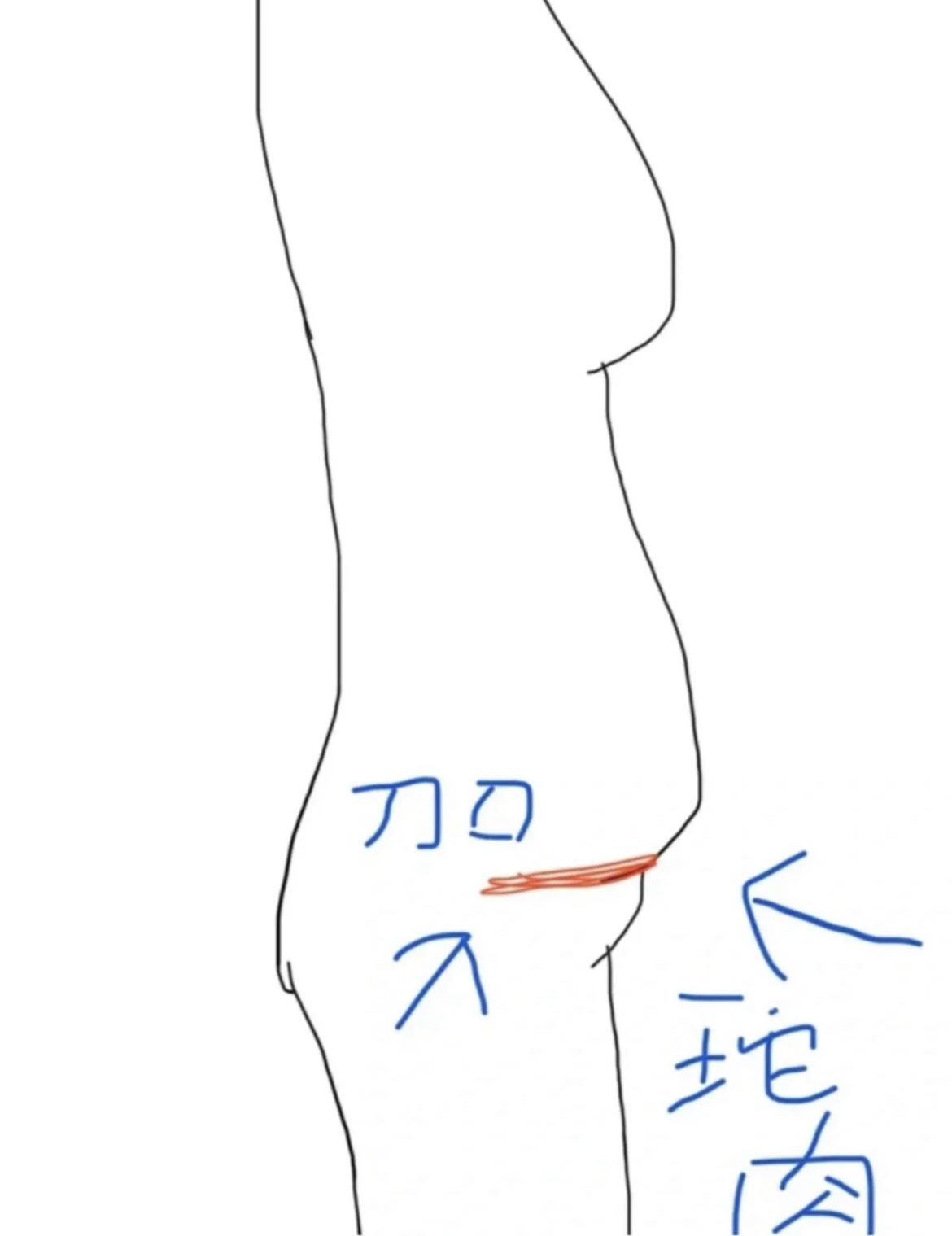 腹部伤口卡通图片图片