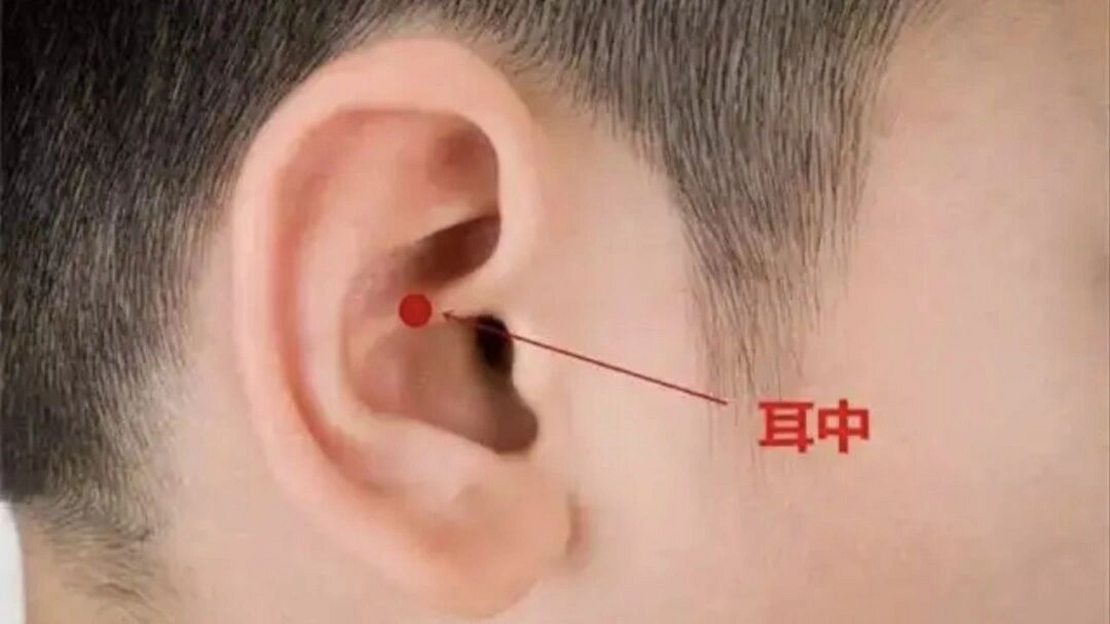 中医【耳穴定位】疗法:认识耳中穴 根据我国制定的国