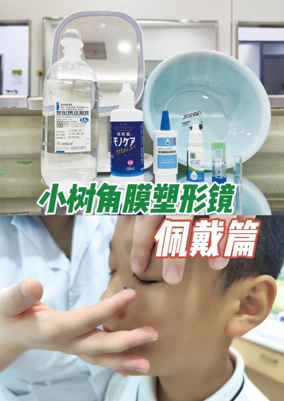 角膜塑形镜【佩戴篇】全攻略 ok镜的正确佩戴及护理,不仅直接决定了其