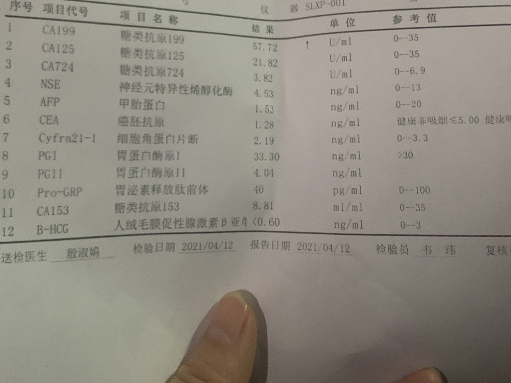 ca199有点高,医生说没事!真正是肿瘤的话会成百上千的涨,让定期复查