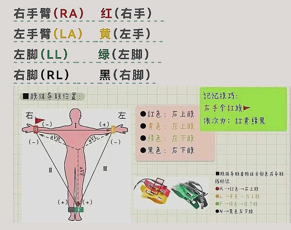 心电图导联位置 笔记