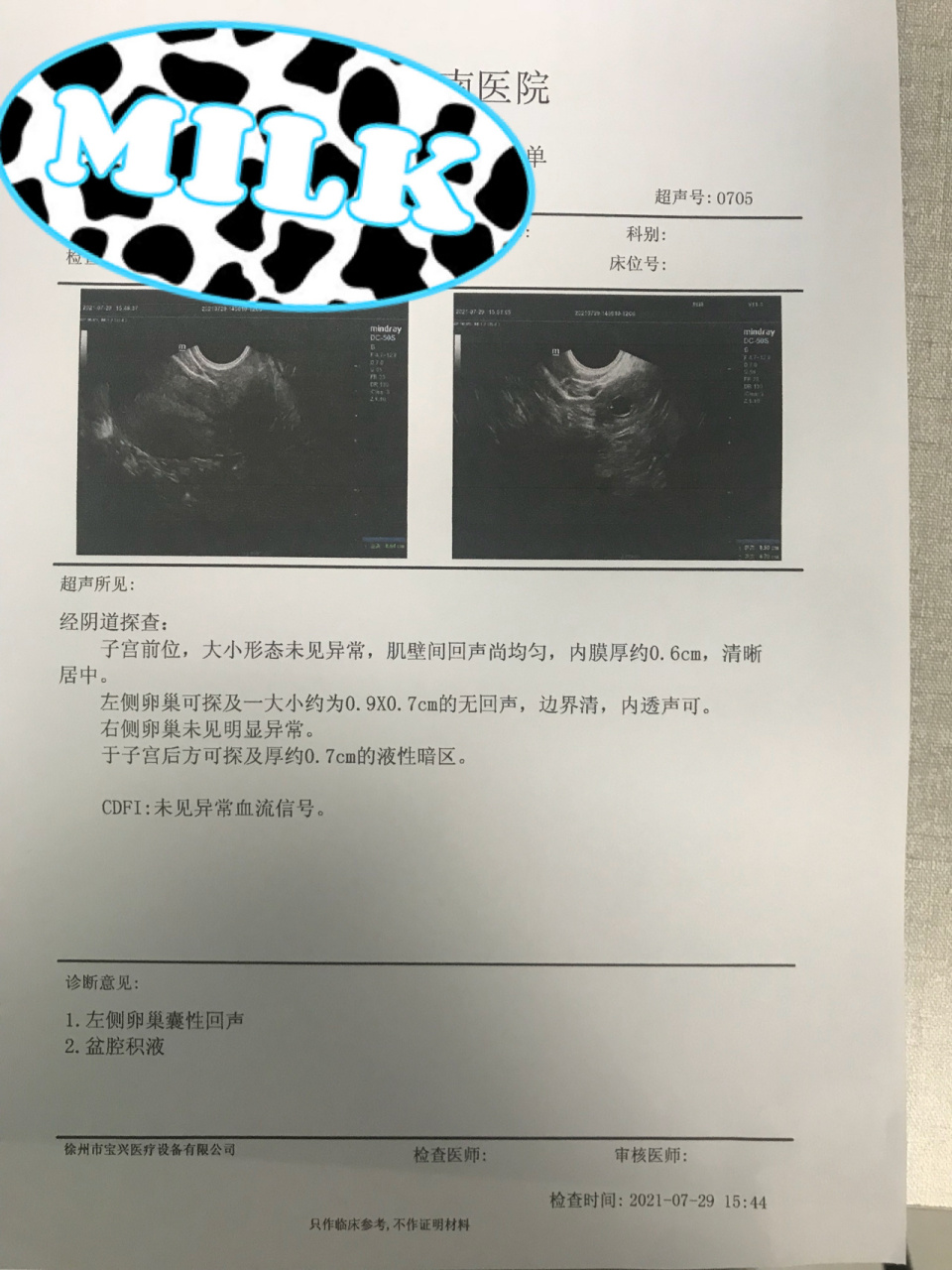 自然流产成功 真的是很佩服自己,医生在判定发育不好建议刮宫的时候
