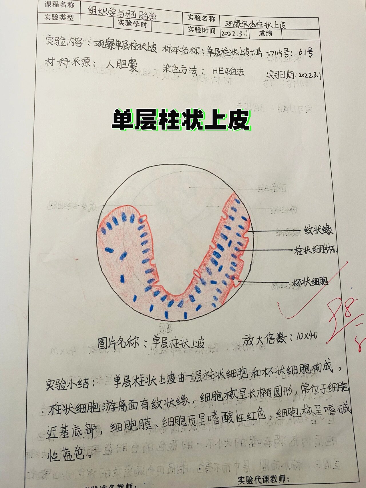 单层柱状上皮图片解析图片