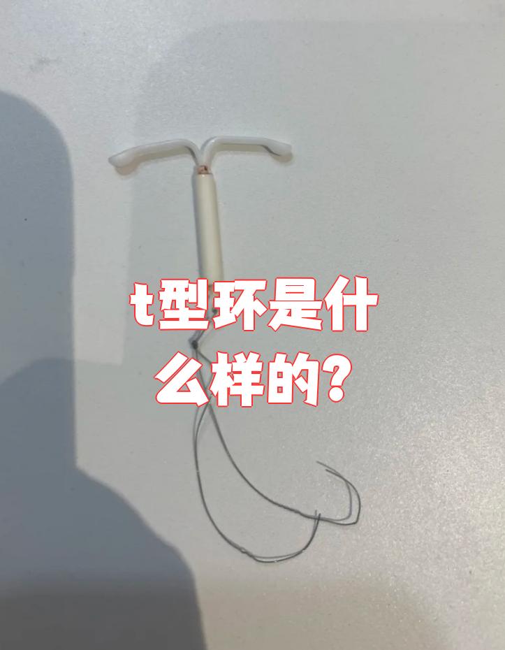 t型环是一种t字形的宫内节育器
