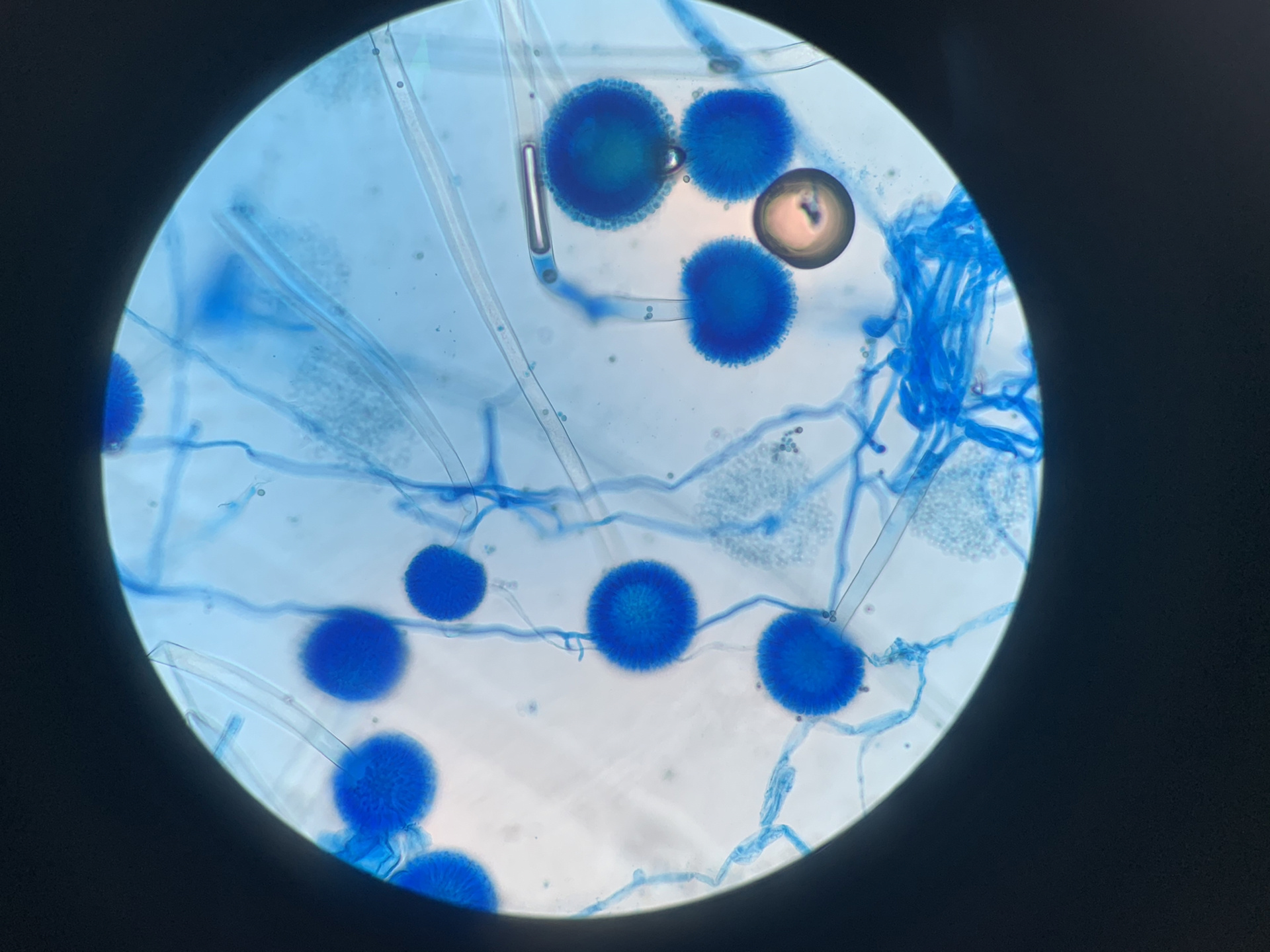 今天给大家分享一组真菌培养及镜下形态图 黄曲霉,顶囊洋梨型,顶囊有