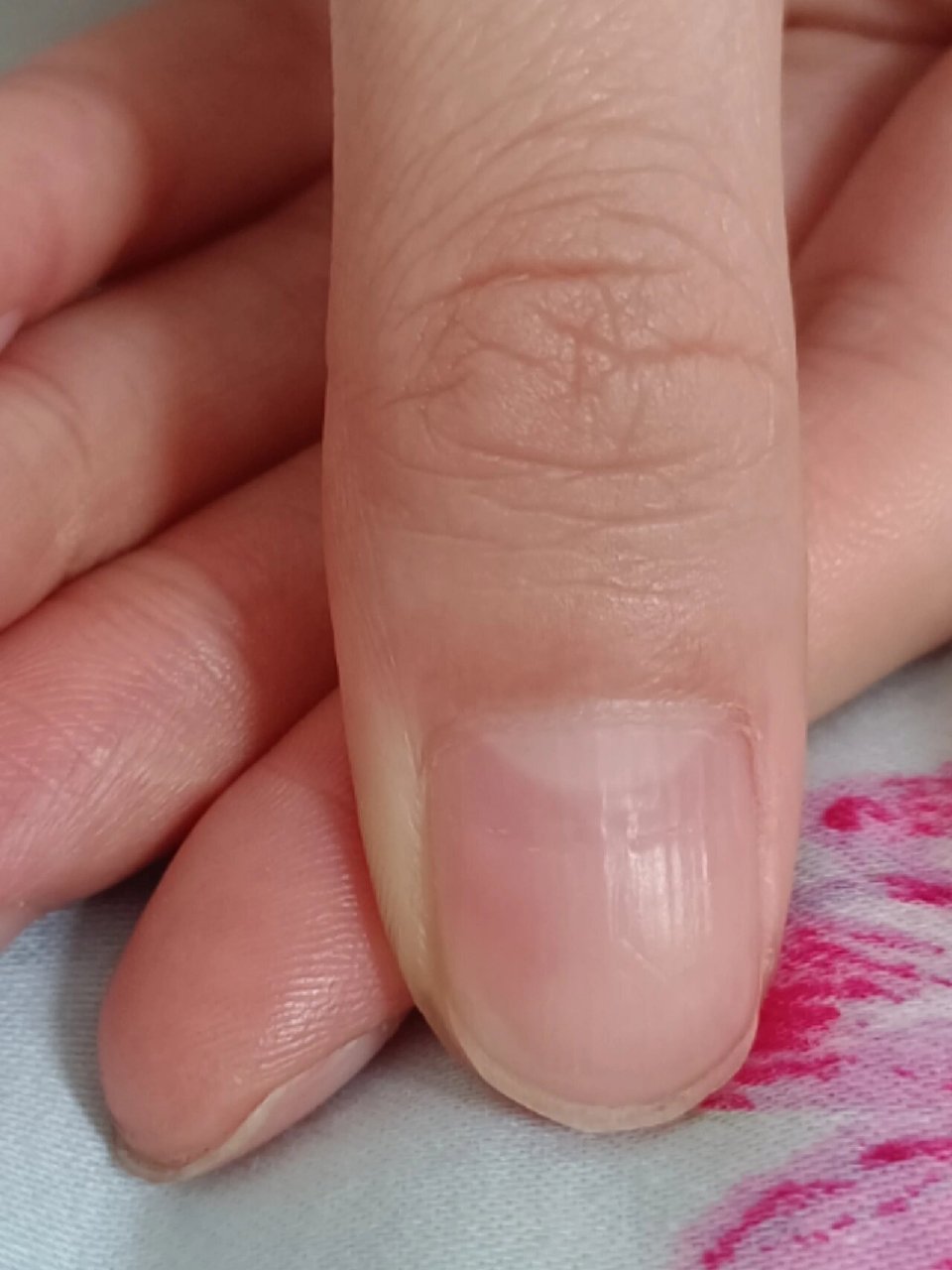 指甲上面有横沟是怎么回事呀 有没有哪位姐妹知道指甲上面的横沟和